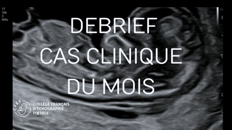 Le cas clinique du mois #1